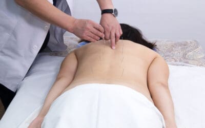 The Long-Term Benefits of Regular Acupuncture