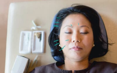 The Science Behind Acupuncture: How Traditional Techniques Benefit Modern Wellness