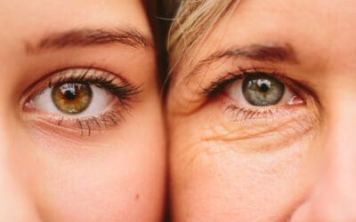 How Acupuncture Enhances Vision: Relief for Common Eye Conditions