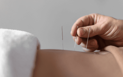 Chinese Acupuncture Albuquerque: Restore Balance & Boost Wellness