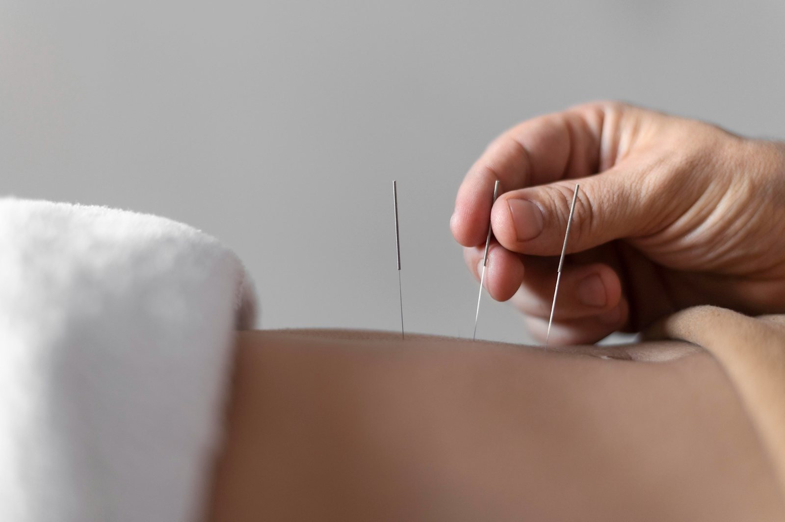 Fertility Specialist in Albuquerque providing acupuncture for reproductive health at Natural Life Acupuncture & Wellness Fertility Specialist in Albuquerque providing acupuncture for reproductive health at Natural Life Acupuncture & Wellness