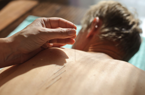 acupuncture for pain relief Acupuncture for Chronic Back Pain Relief in Albuquerque
