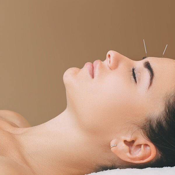facial acupuncture